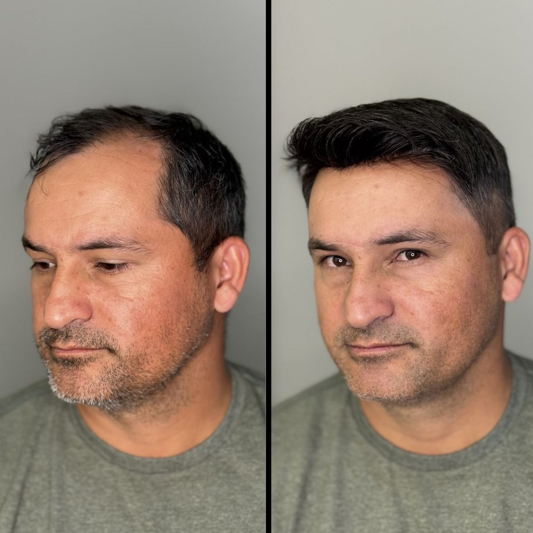 Resultado 6